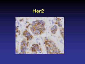 必要に応じた細胞診・組織診07