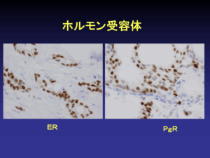 必要に応じた細胞診・組織診06