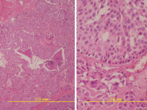 必要に応じた細胞診・組織診05