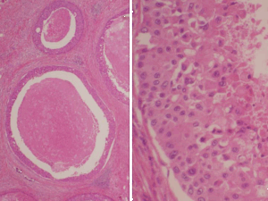 必要に応じた細胞診・組織診04